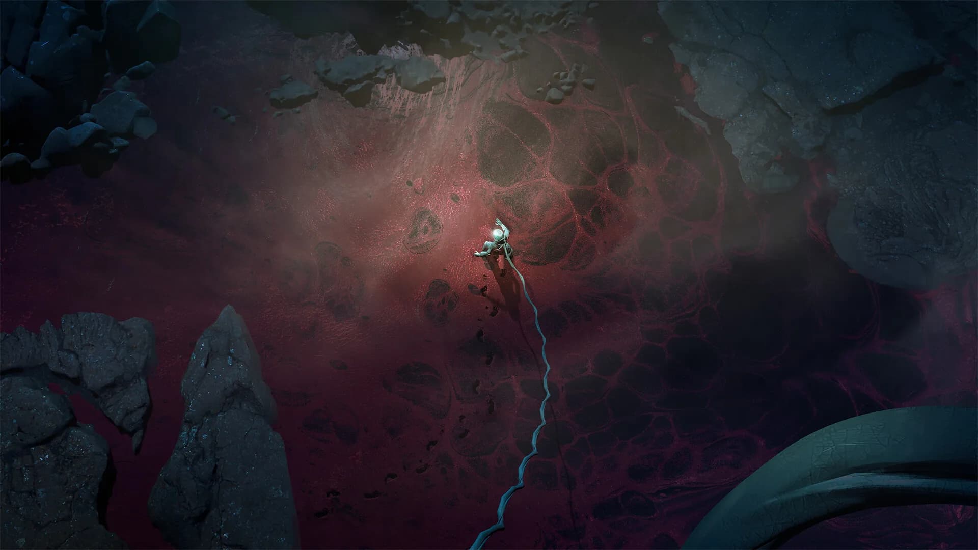 Umbilical görsel 4