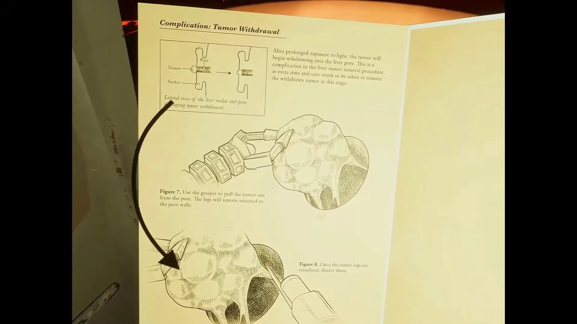 Marion Surgical Robot Game görsel 3