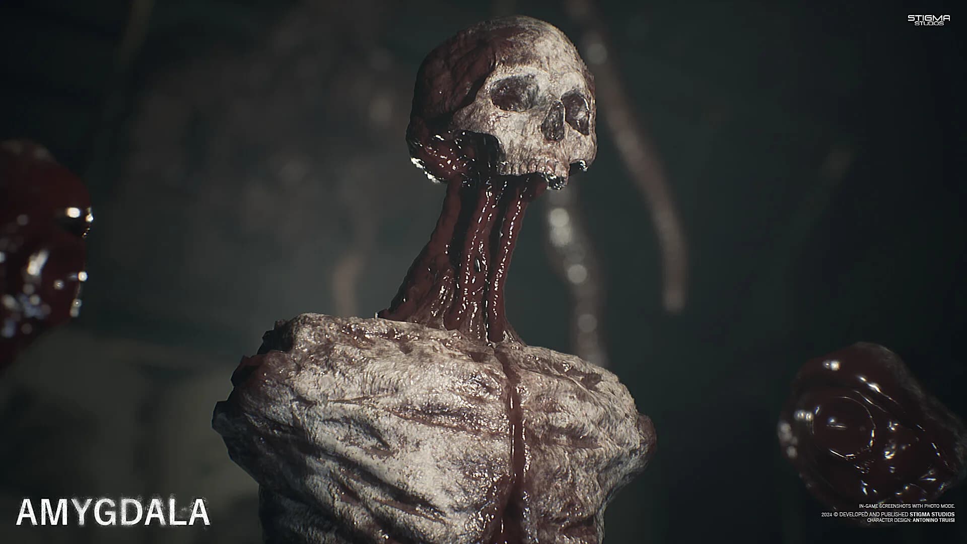 Amygdala görsel 5