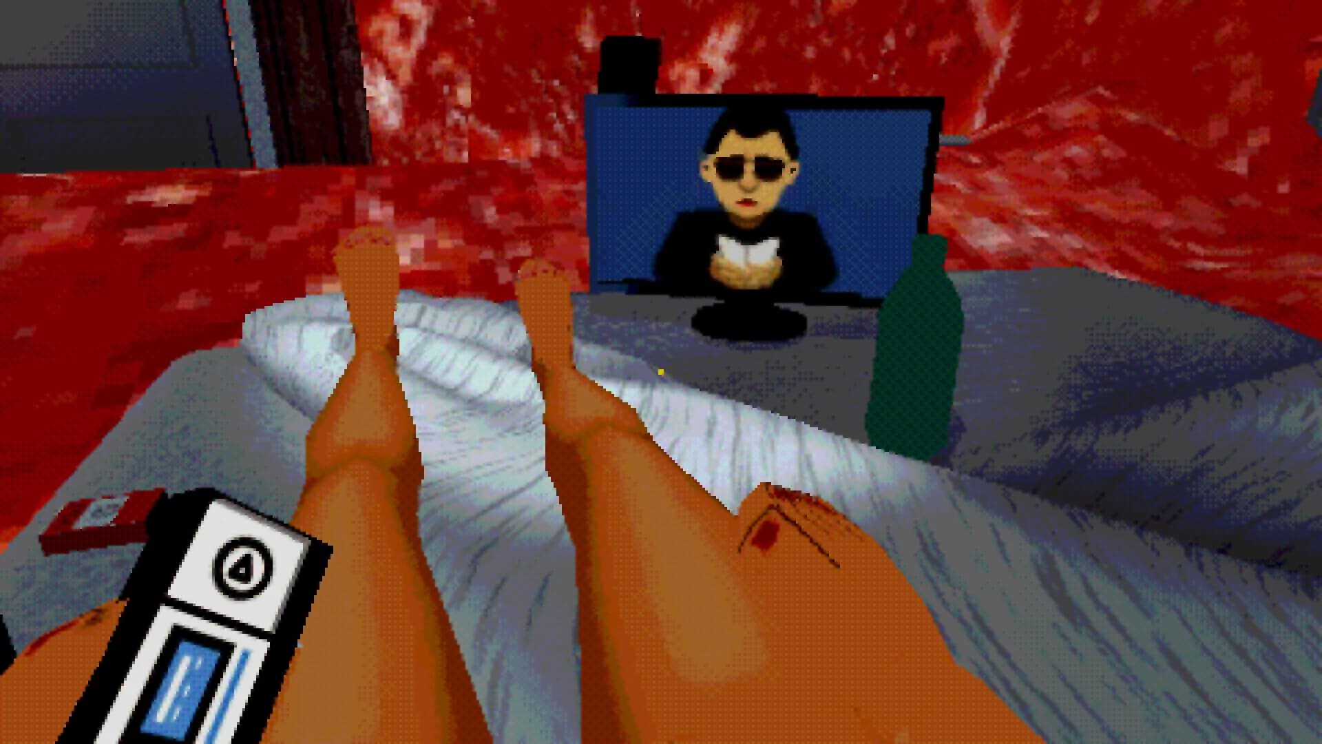 Bedrotting görsel 2