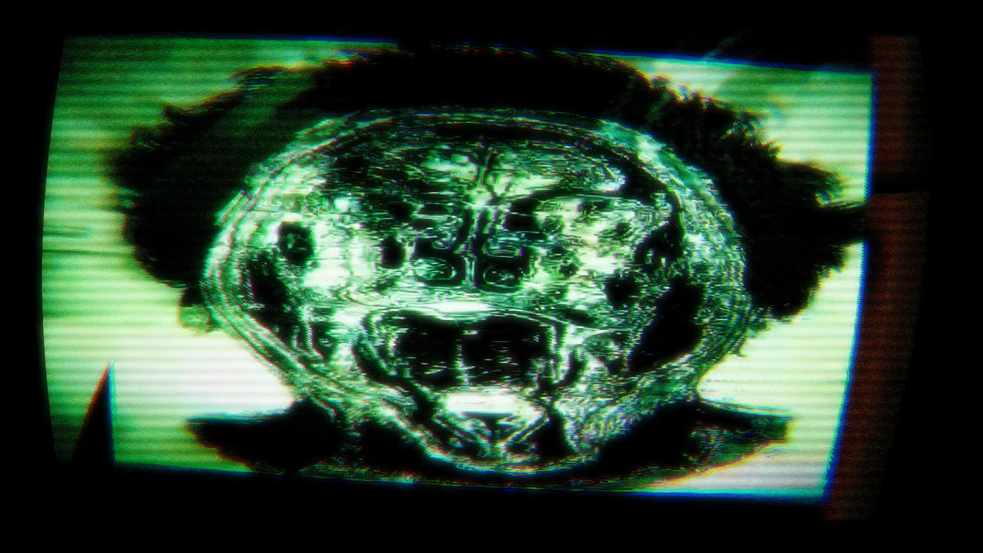 Youchosis görsel 14