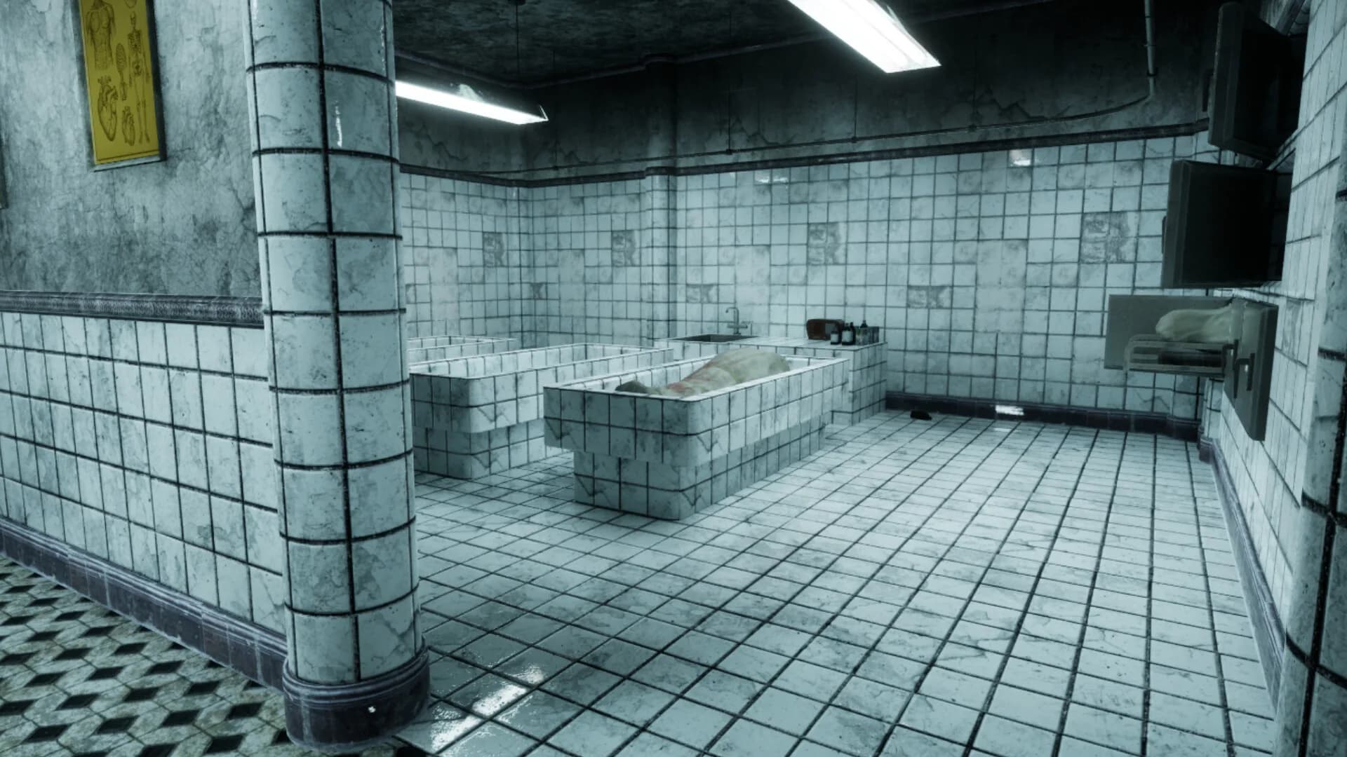 ICU Anomaly görsel 3
