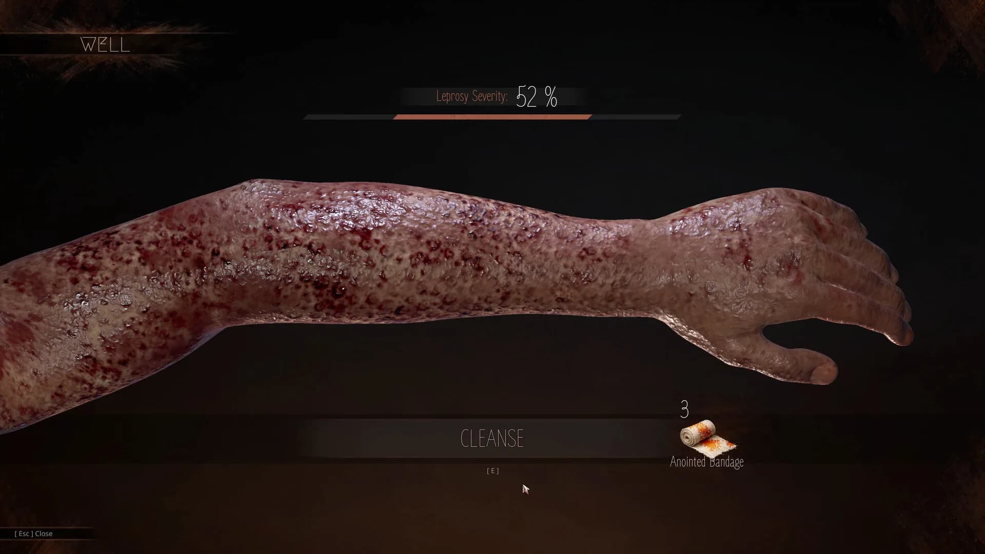 The Abased görsel 13
