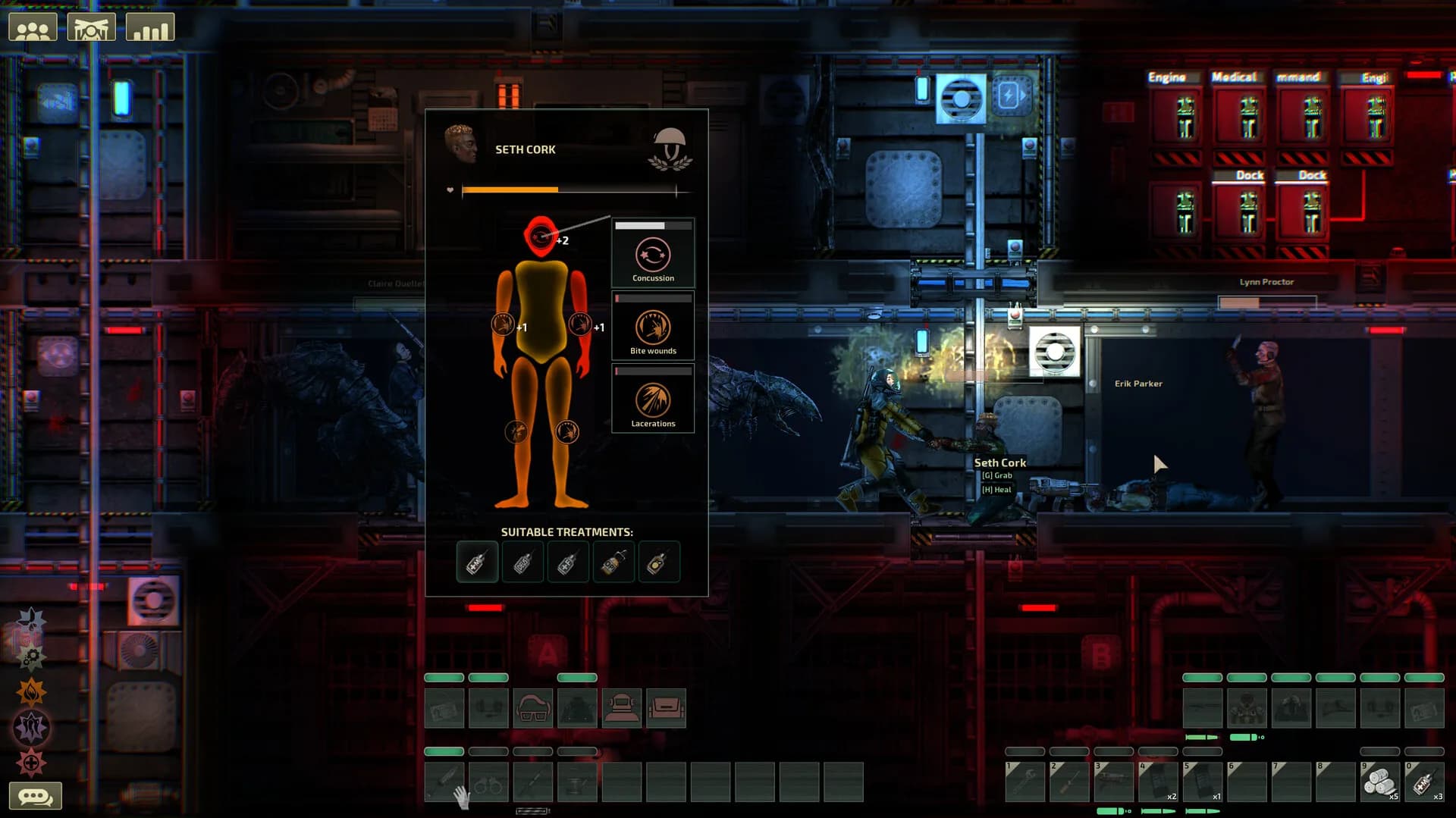 Barotrauma görsel 6