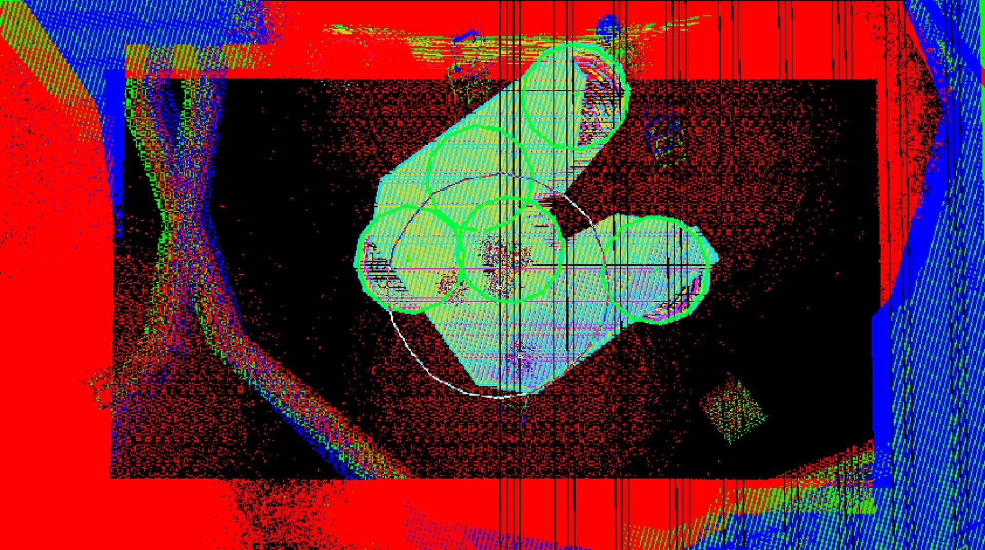 Nerve Damage görsel 6